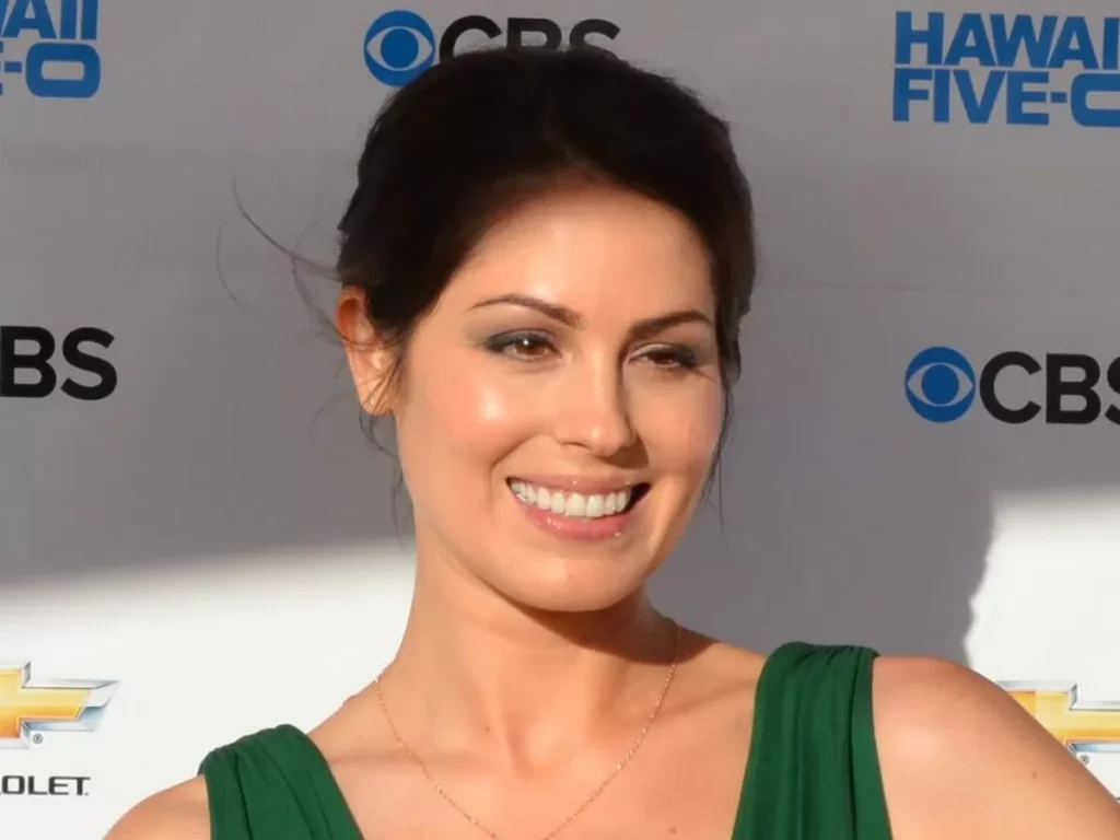 Michelle Borth Plastic Surgery and Body Measurements