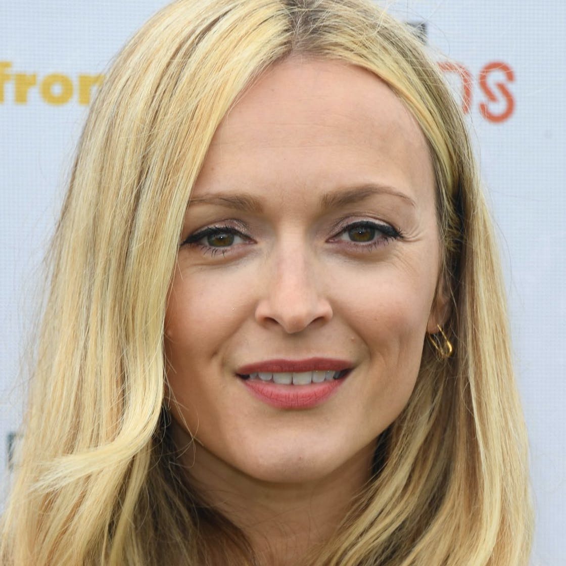 Fearne Cotton Cosmetic Surgery Face