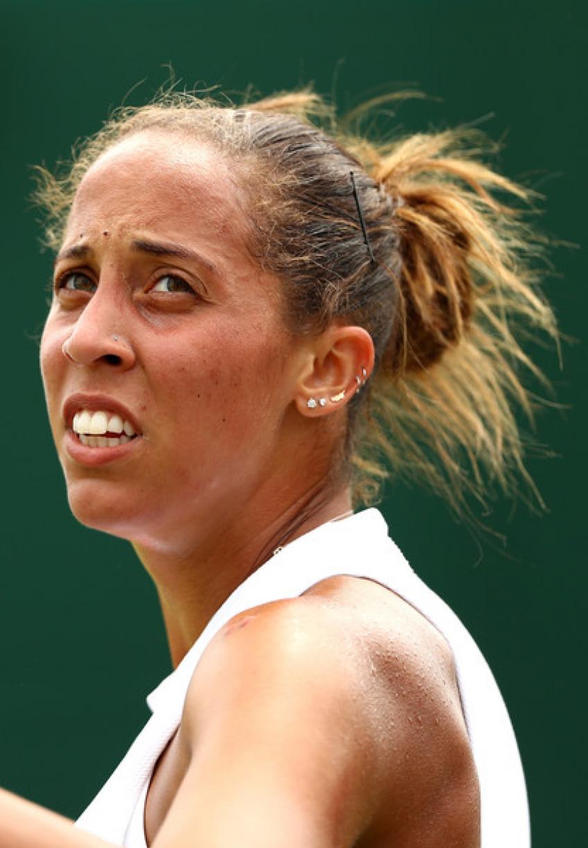 Madison Keys Cosmetic Surgery Face