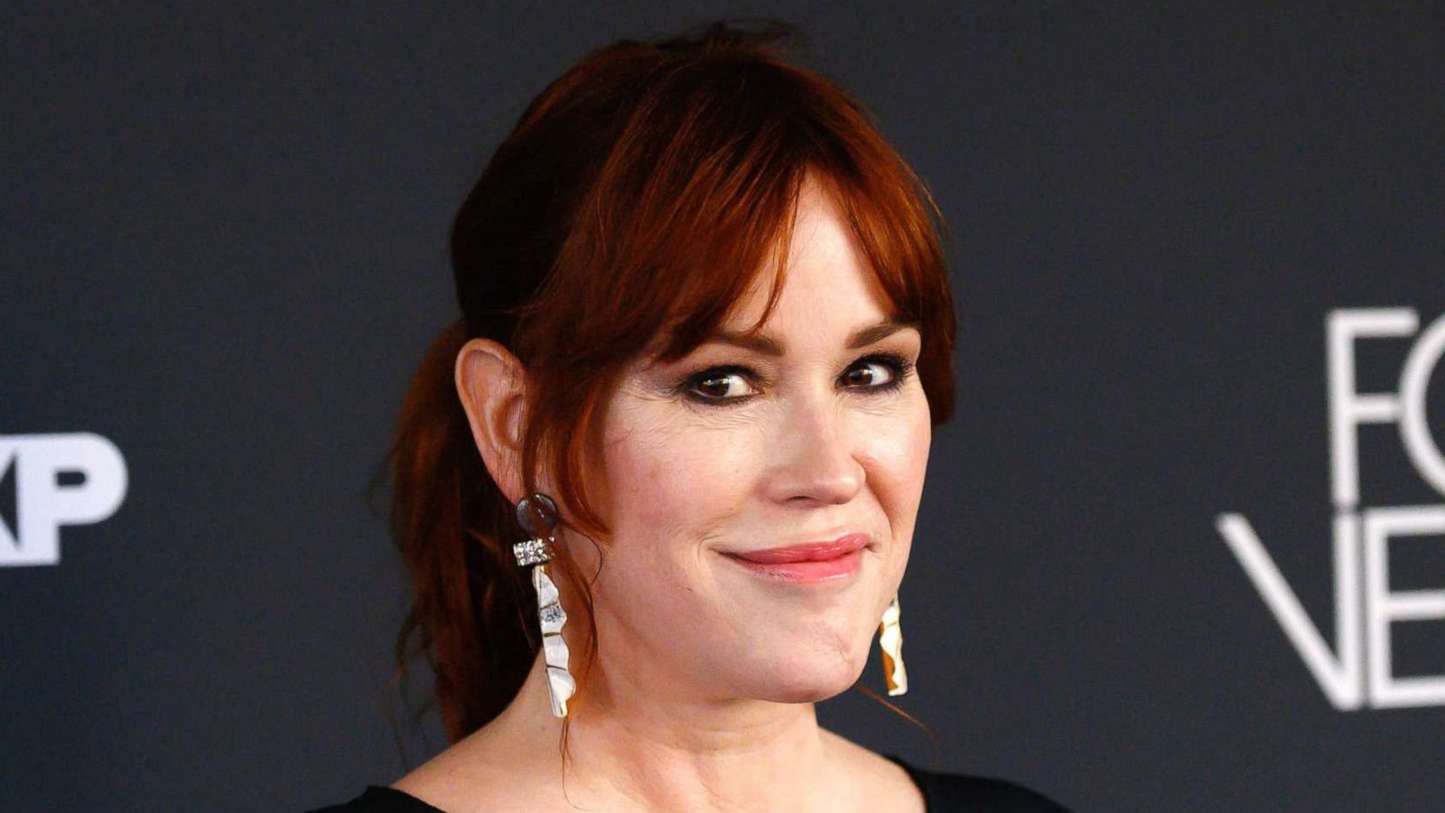 Molly Ringwald Plastic Surgery