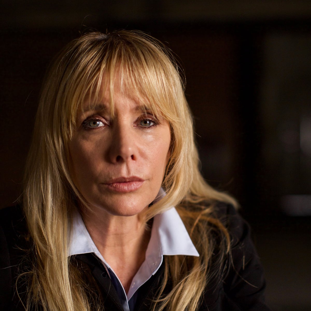 Rosanna Arquette Plastic Surgery Face