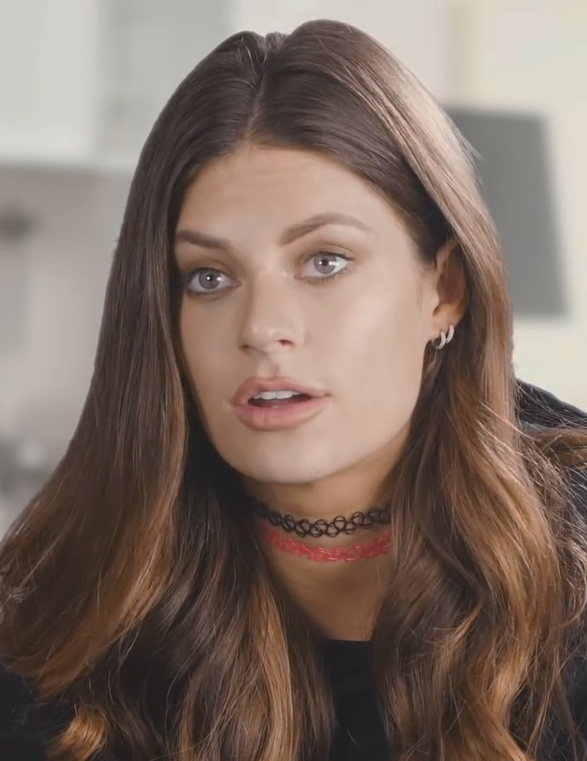 Hannah Stocking Cosmetic Surgery Face