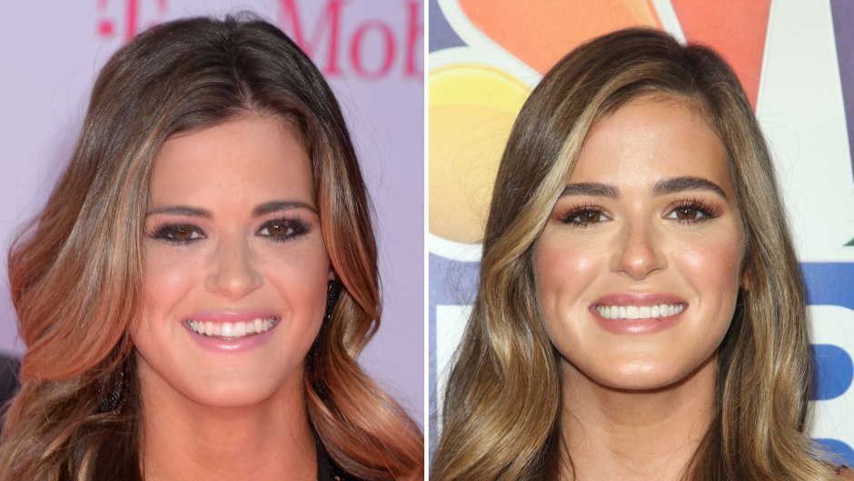 JoJo Fletcher Plastic Surgery Face