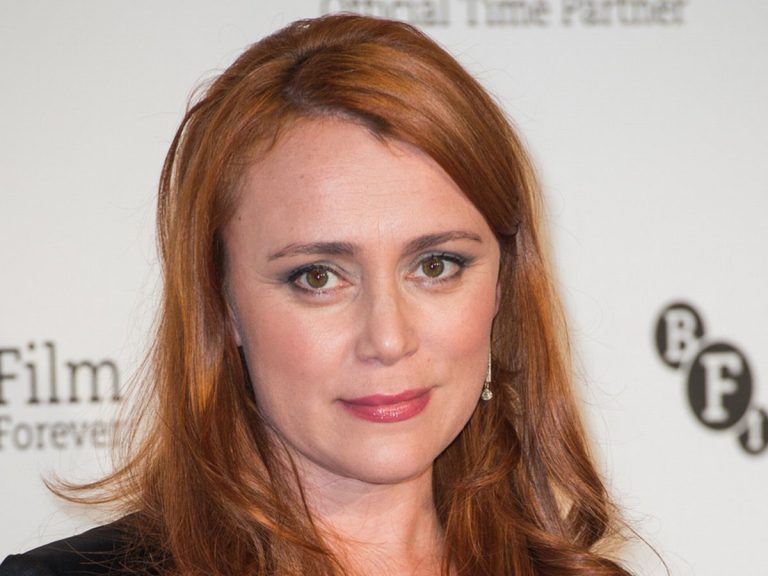 Keeley Hawes Cosmetic Surgery