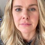 Laura Bell Bundy Cosmetic Surgery Nose Job