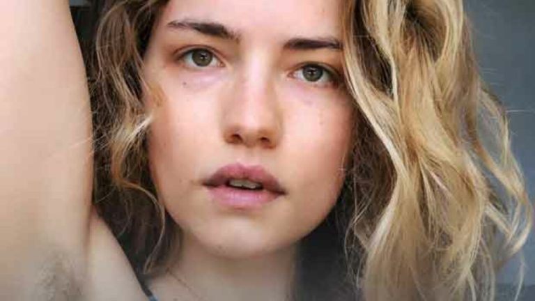 Willa Fitzgerald Plastic Surgery Procedures