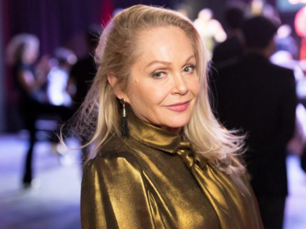 Charlene Tilton Plastic Surgery and Body Measurements
