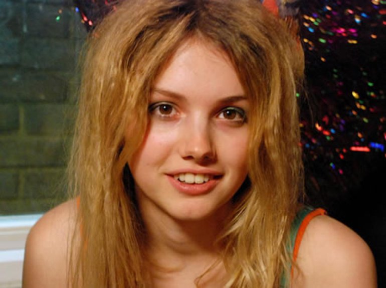 Hannah Murray Cosmetic Surgery