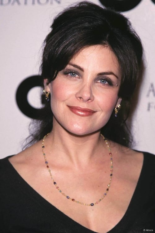 Sherilyn Fenn Plastic Surgery Face