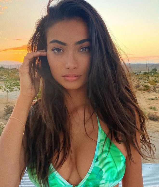 Kelly Gale Cosmetic Surgery Face