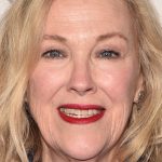 Catherine O'Hara Cosmetic Surgery