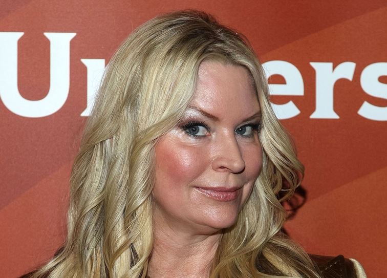 Jackie Siegel Plastic Surgery Face