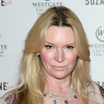 Jackie Siegel Plastic Surgery Procedures