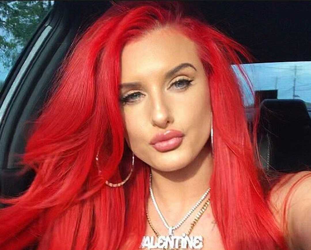 Justina Valentine Plastic Surgery Face