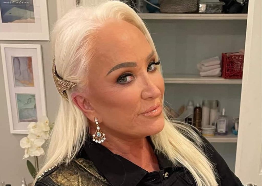 Tanya Tucker Plastic Surgery Procedures