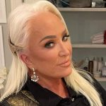Tanya Tucker Plastic Surgery Procedures