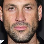 Maksim Chmerkovskiy Plastic Surgery