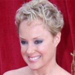 Sally Dynevor Cosmetic Surgery