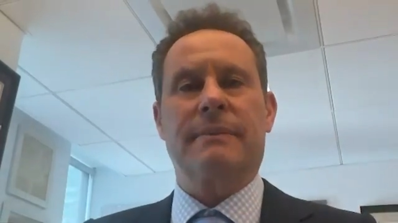 Brian Kilmeade Cosmetic Surgery Face