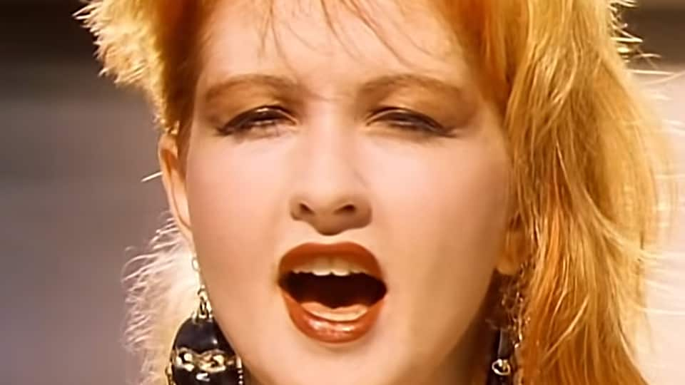 Cyndi Lauper Cosmetic Surgery Face