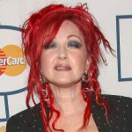 Cyndi Lauper Plastic Surgery
