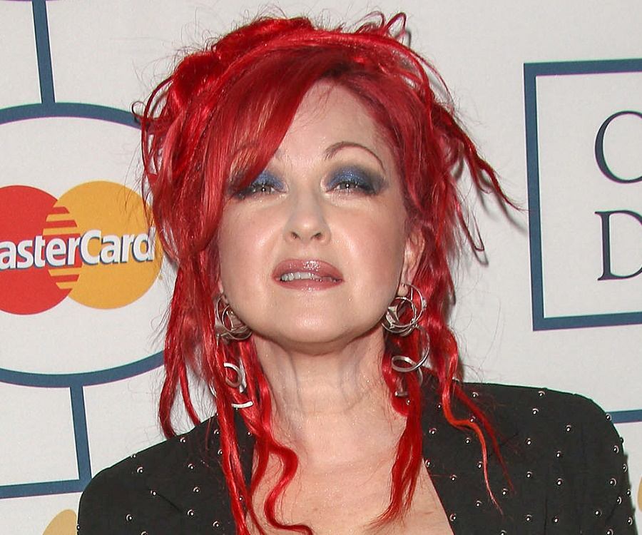 Cyndi Lauper Plastic Surgery
