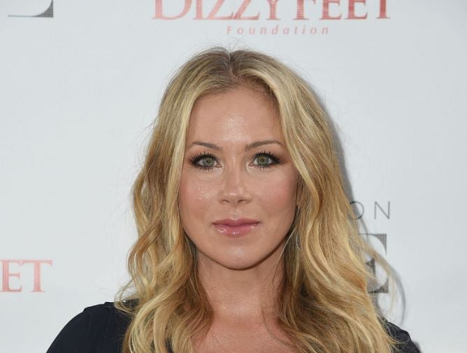 Christina Applegate Plastic Surgery Procedures