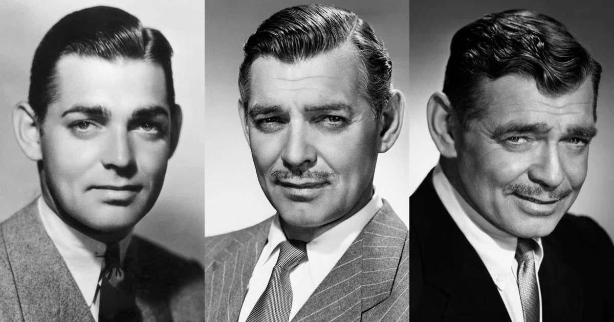 Clark Gable Cosmetic Surgery Face