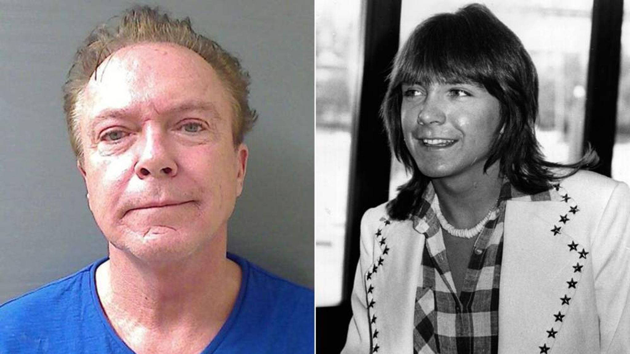 David Cassidy Cosmetic Surgery Face