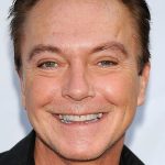 David Cassidy Plastic Surgery