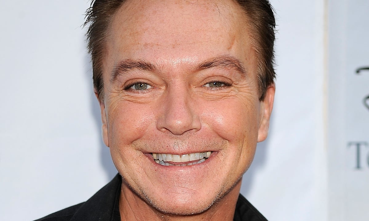 What plastic surgery has david cassidy had plastic surgery stars