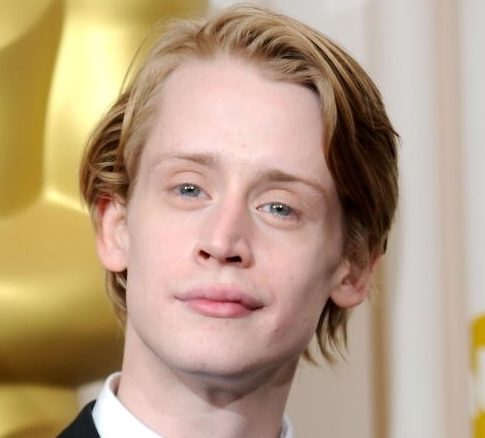 Macaulay Culkin Cosmetic Surgery