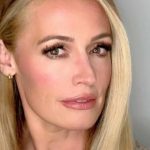 Cat Deeley Plastic Surgery