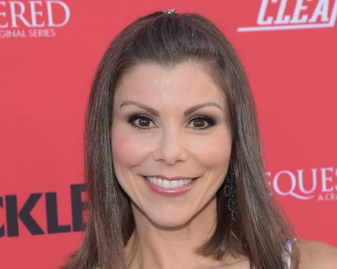 Heather Dubrow Cosmetic Surgery