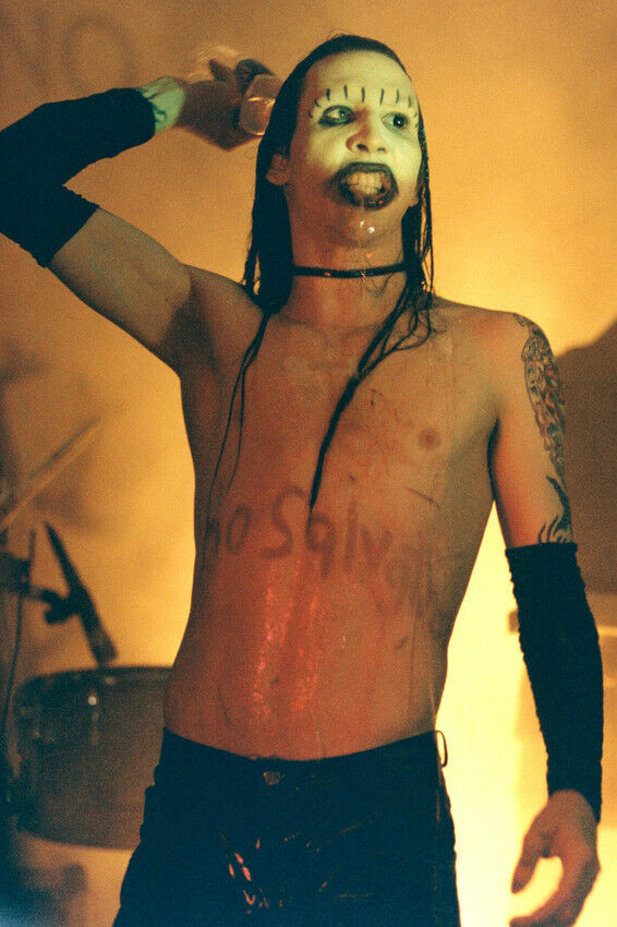 Marilyn Manson Cosmetic Surgery Body