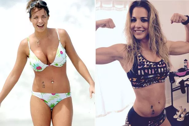 Gemma Atkinson Plastic Surgery Body