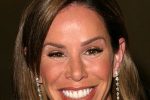 Melissa Rivers Cosmetic Surgery
