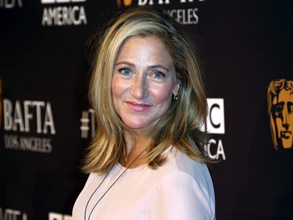 Edie Falco Plastic Surgery and Body Measurements