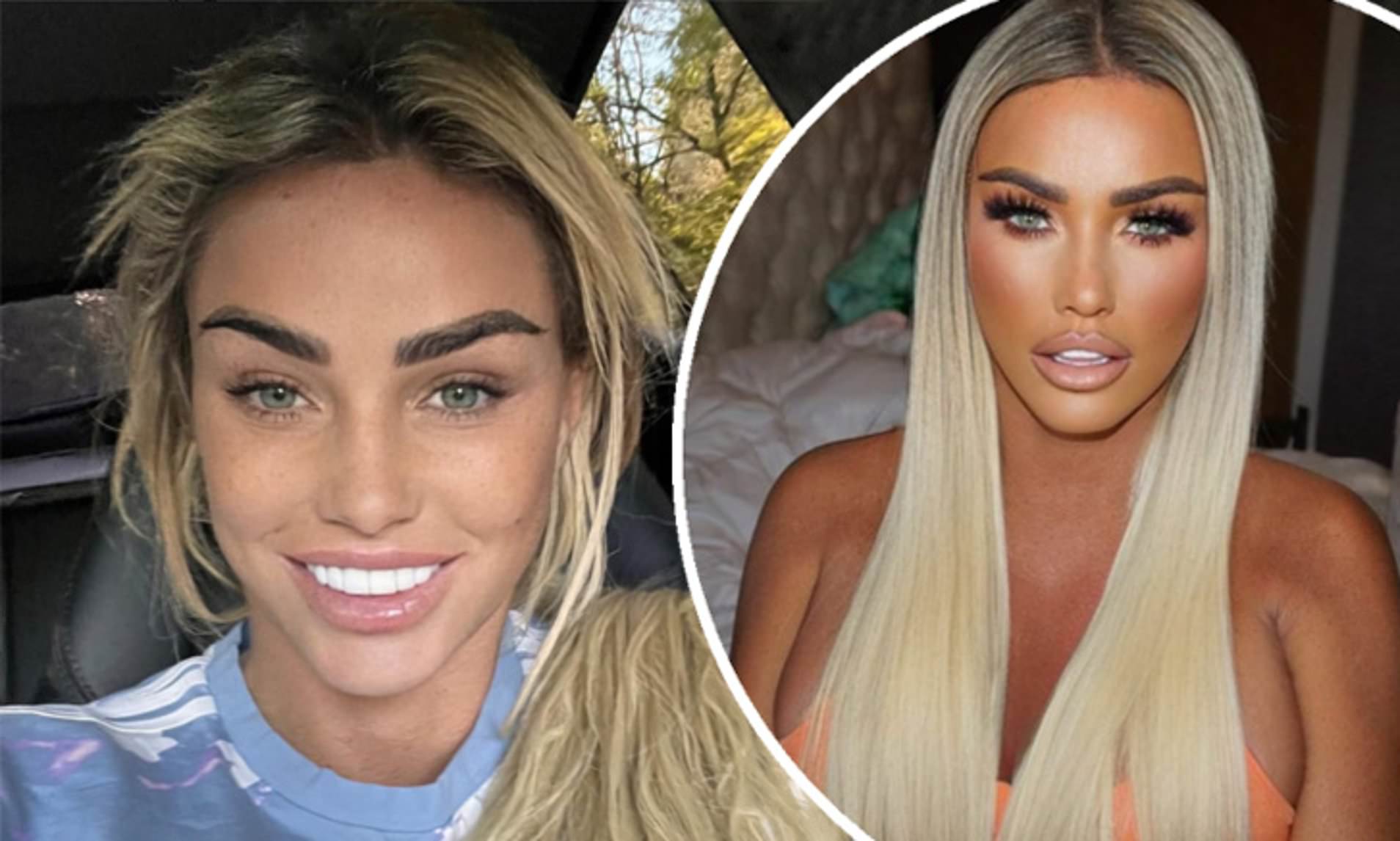 Katie Price's Boob Job Before and After Images Plastic Surgery Stars