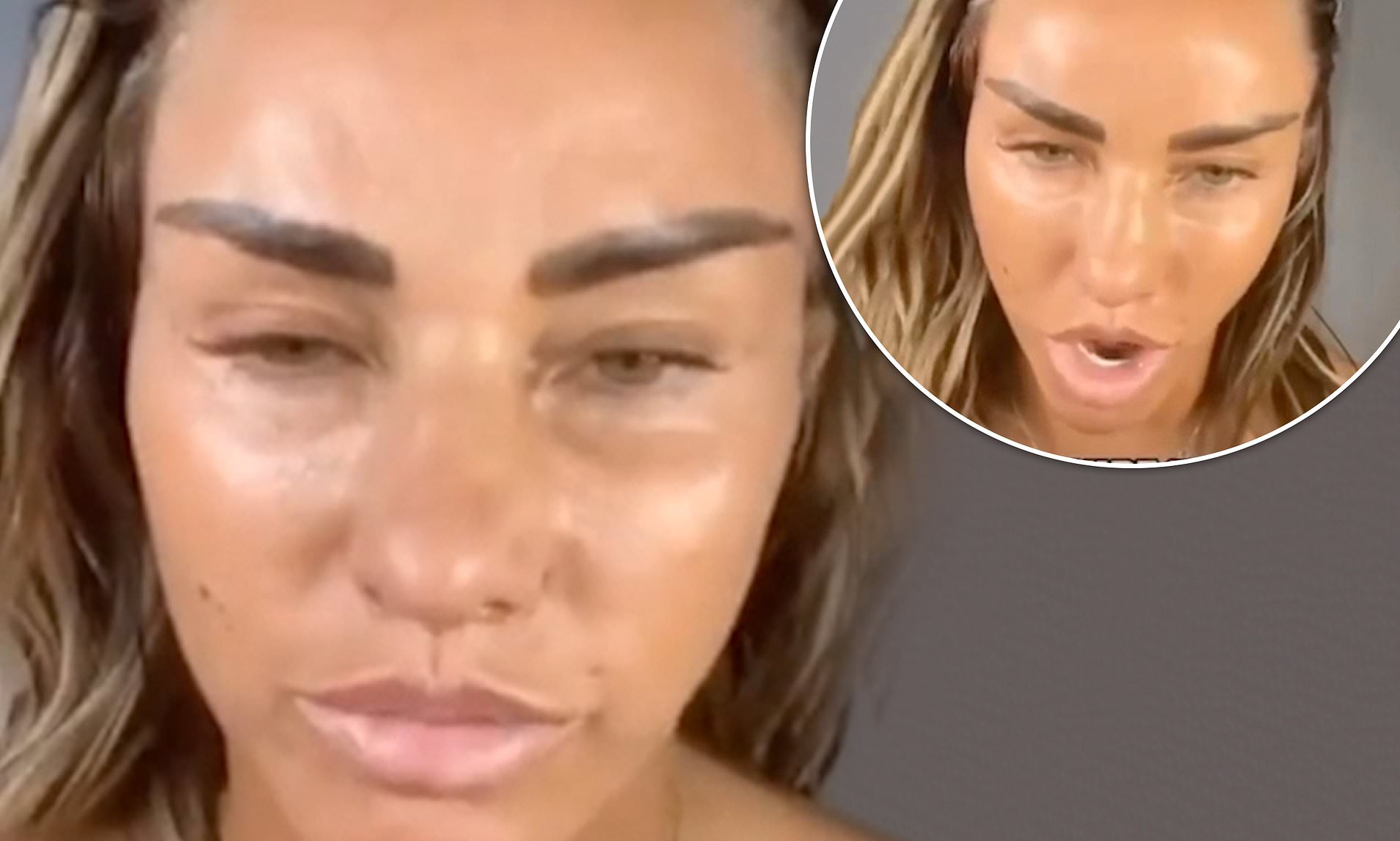 Katie Price Plastic Surgery Face